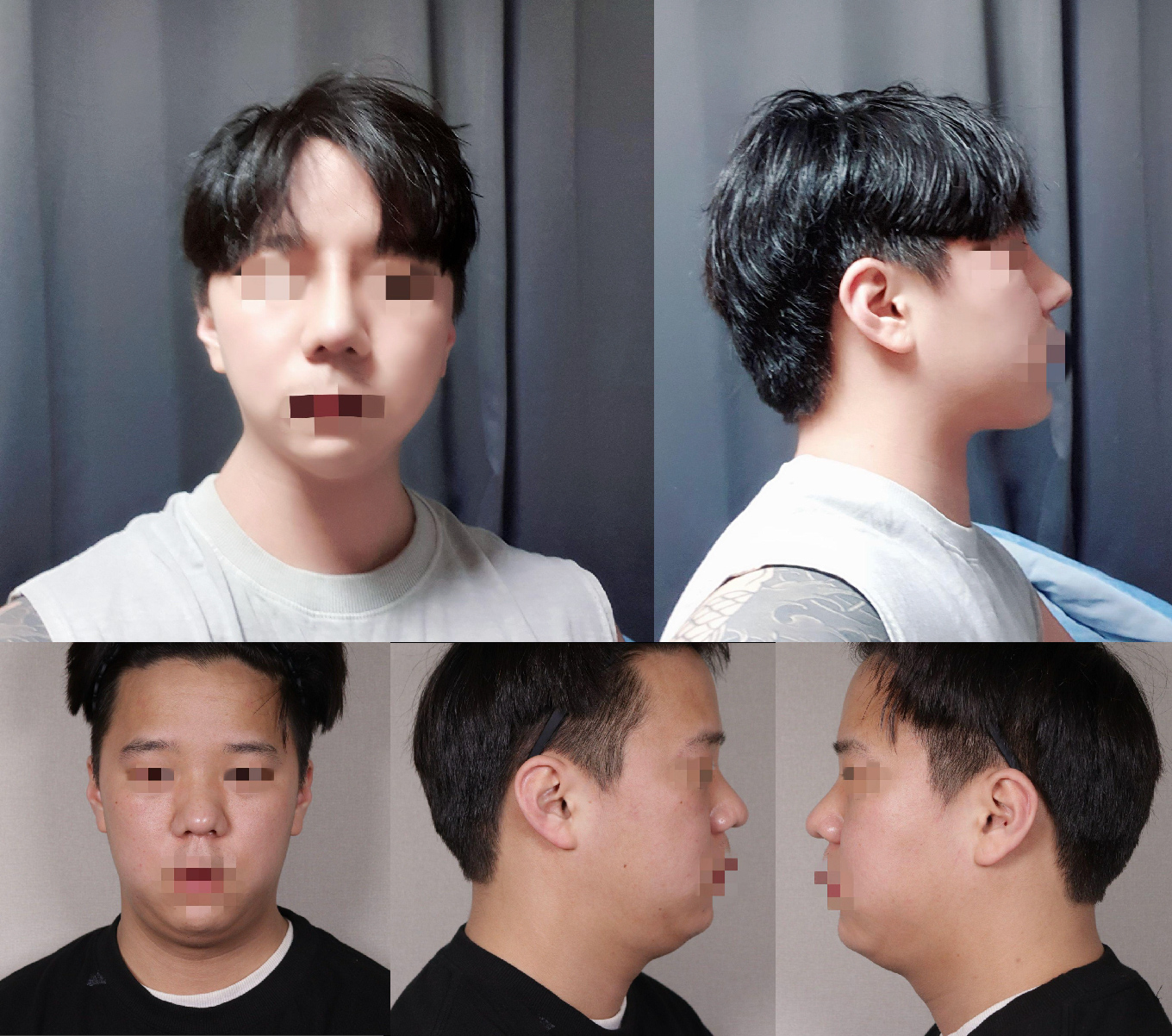 수술후기이미지