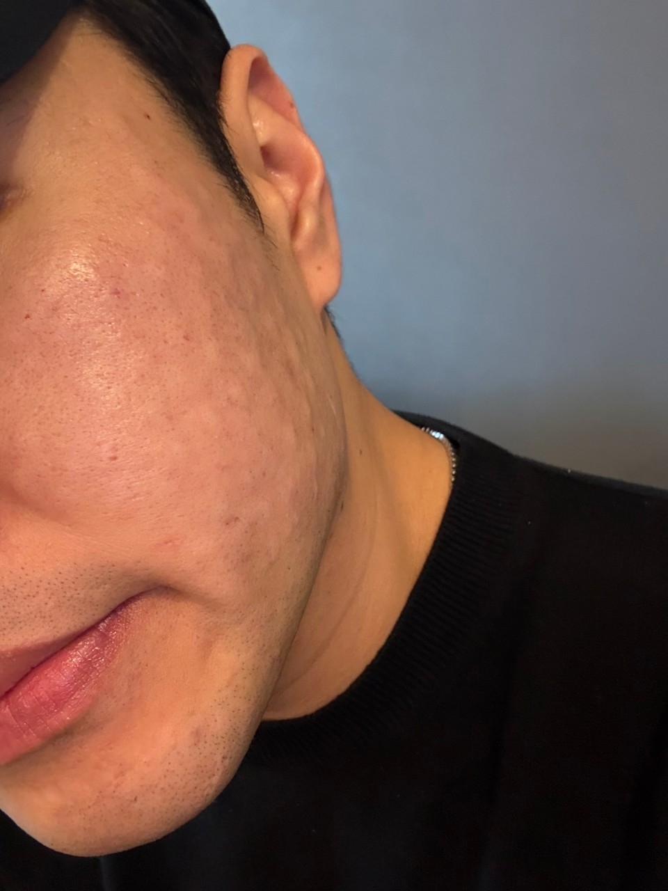 수술후기이미지