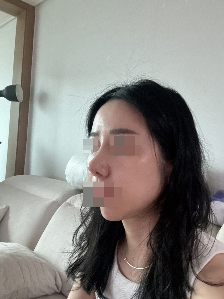 수술후기이미지