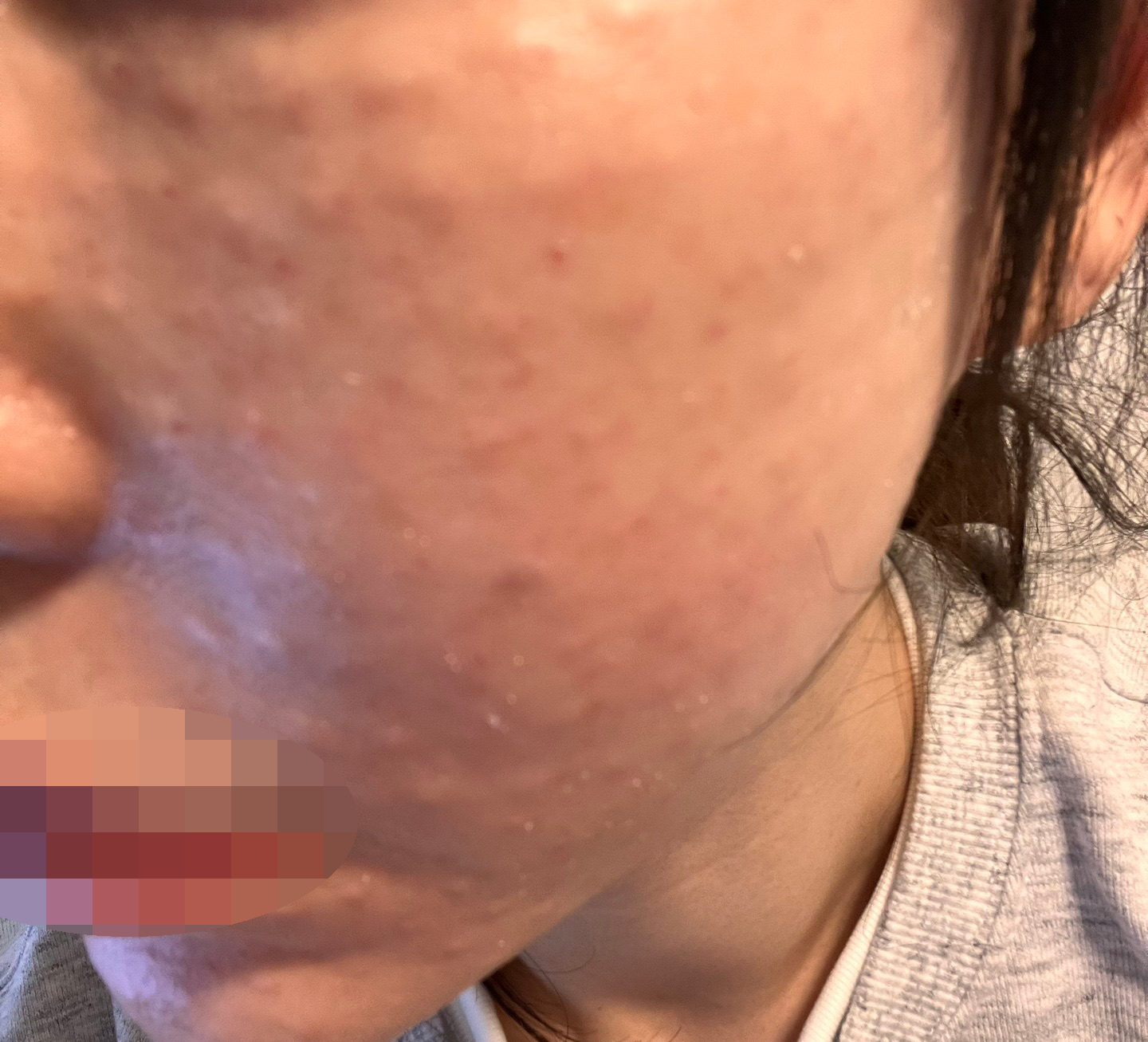 수술후기이미지