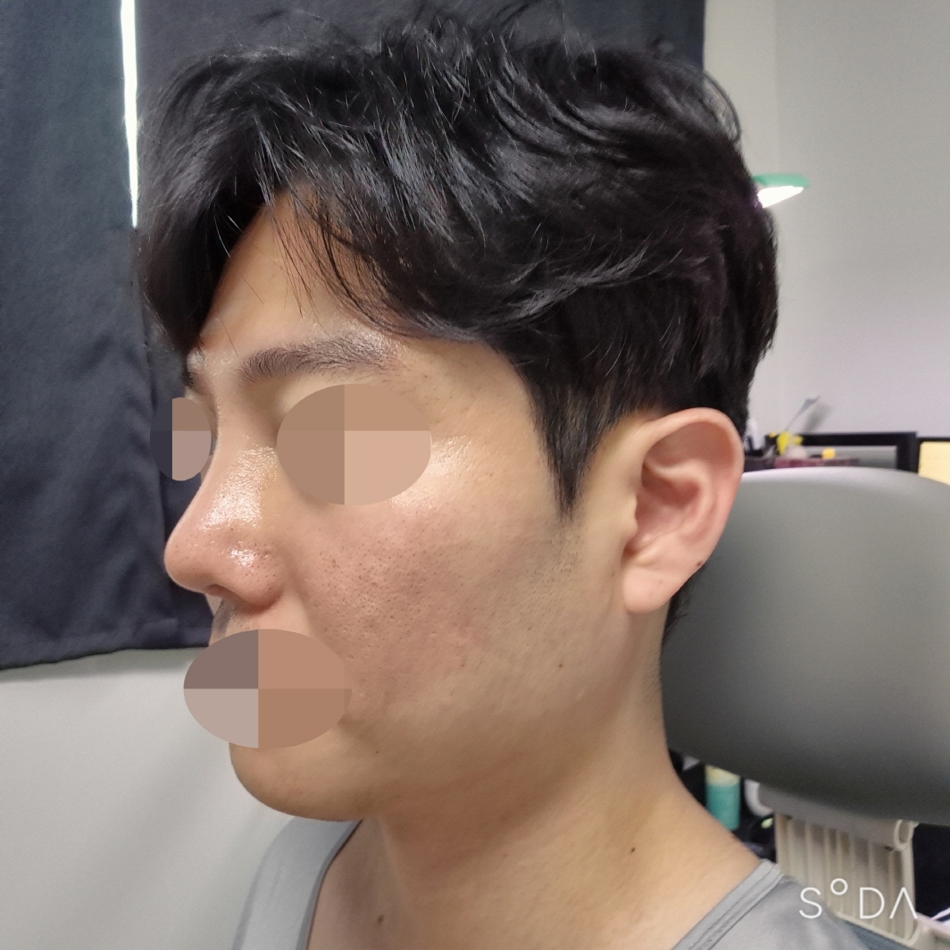 수술후기이미지