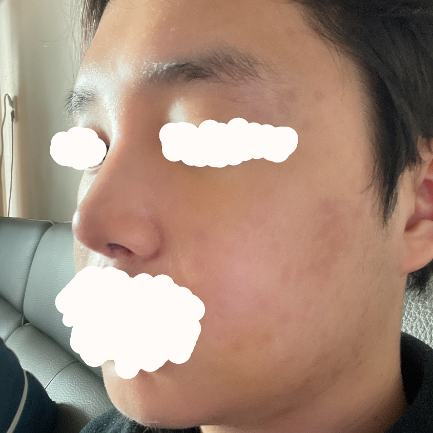 수술후기이미지