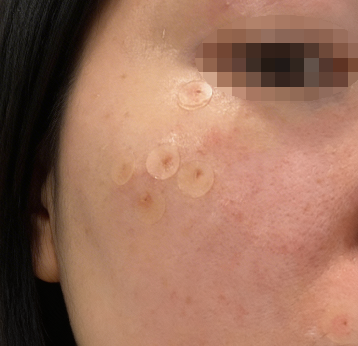 수술후기이미지