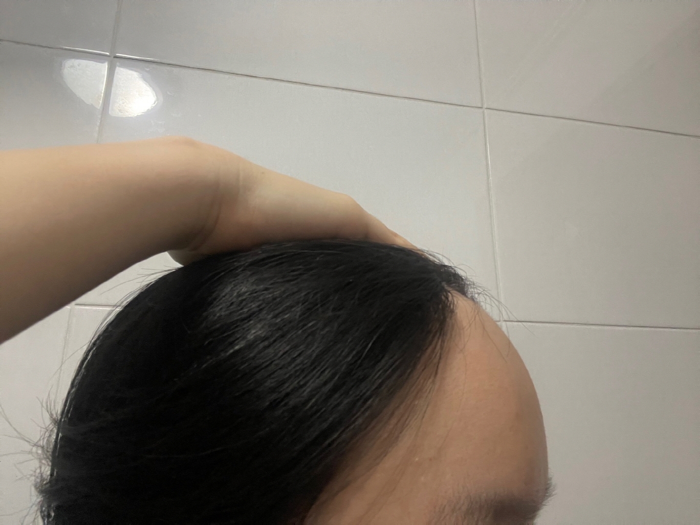 수술후기이미지