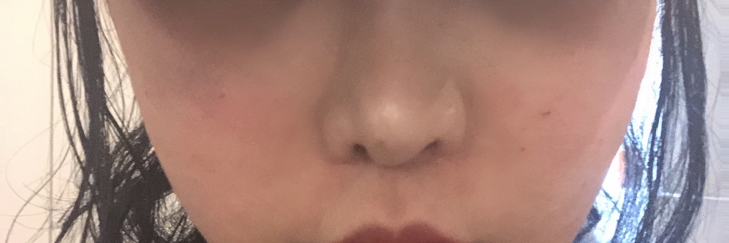 수술후기이미지