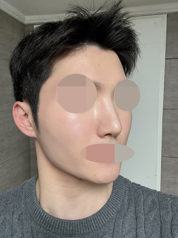 수술후기이미지