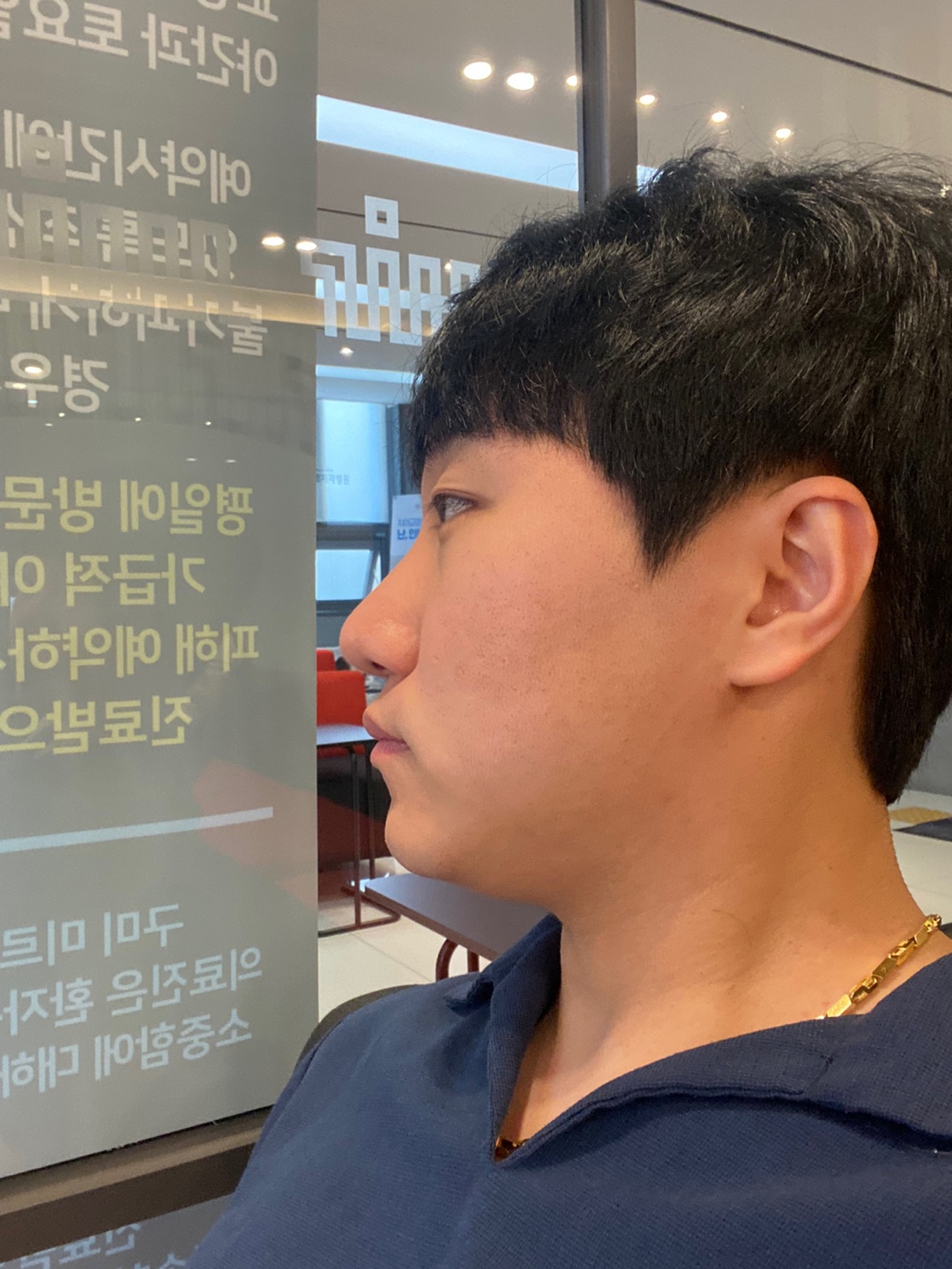 수술후기이미지