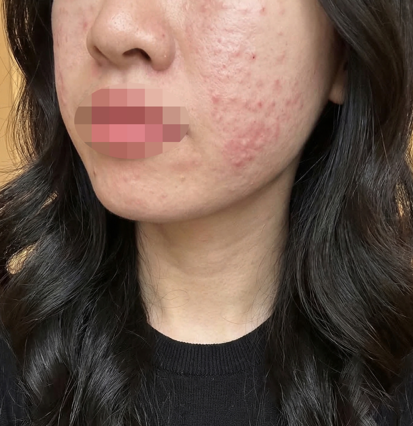 수술후기이미지