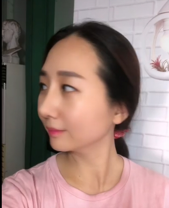 수술후기이미지