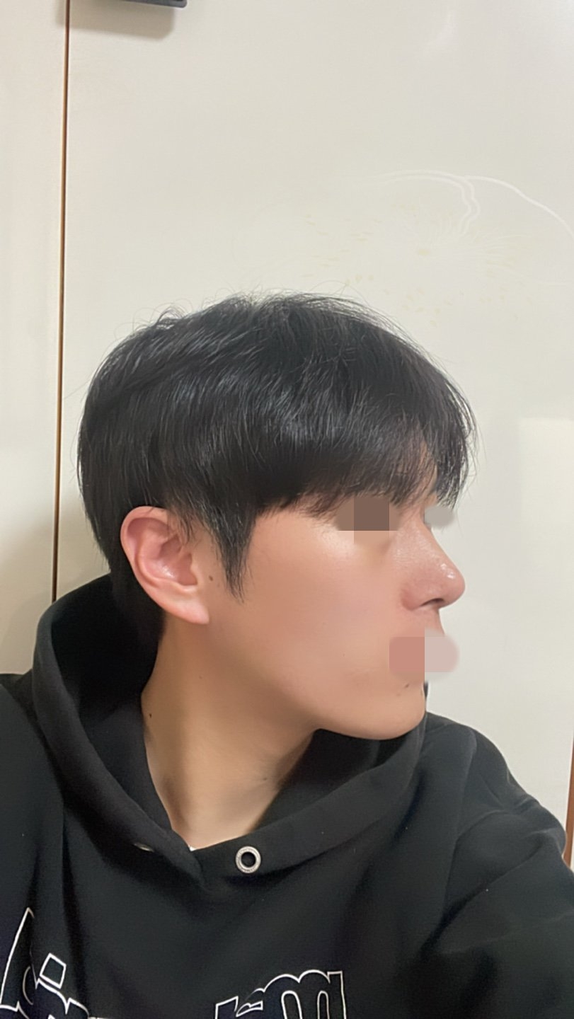 수술후기이미지