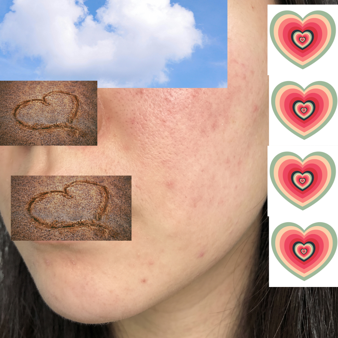 수술후기이미지