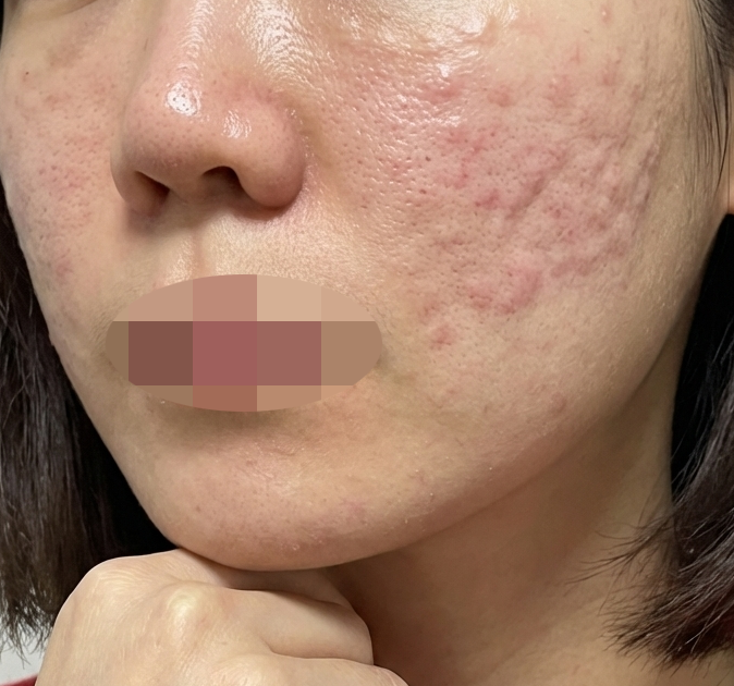 수술후기이미지