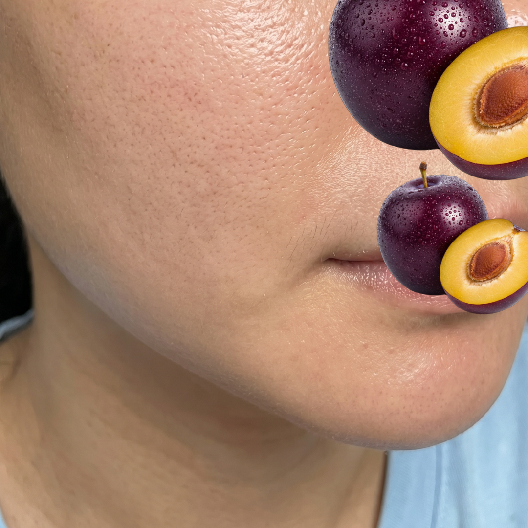 수술후기이미지