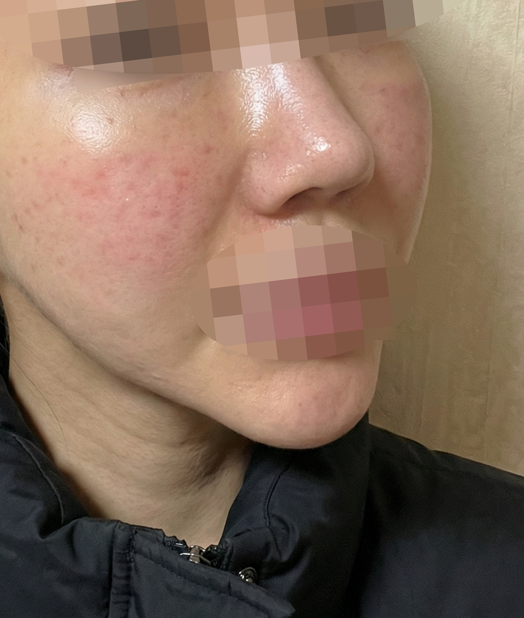 수술후기이미지