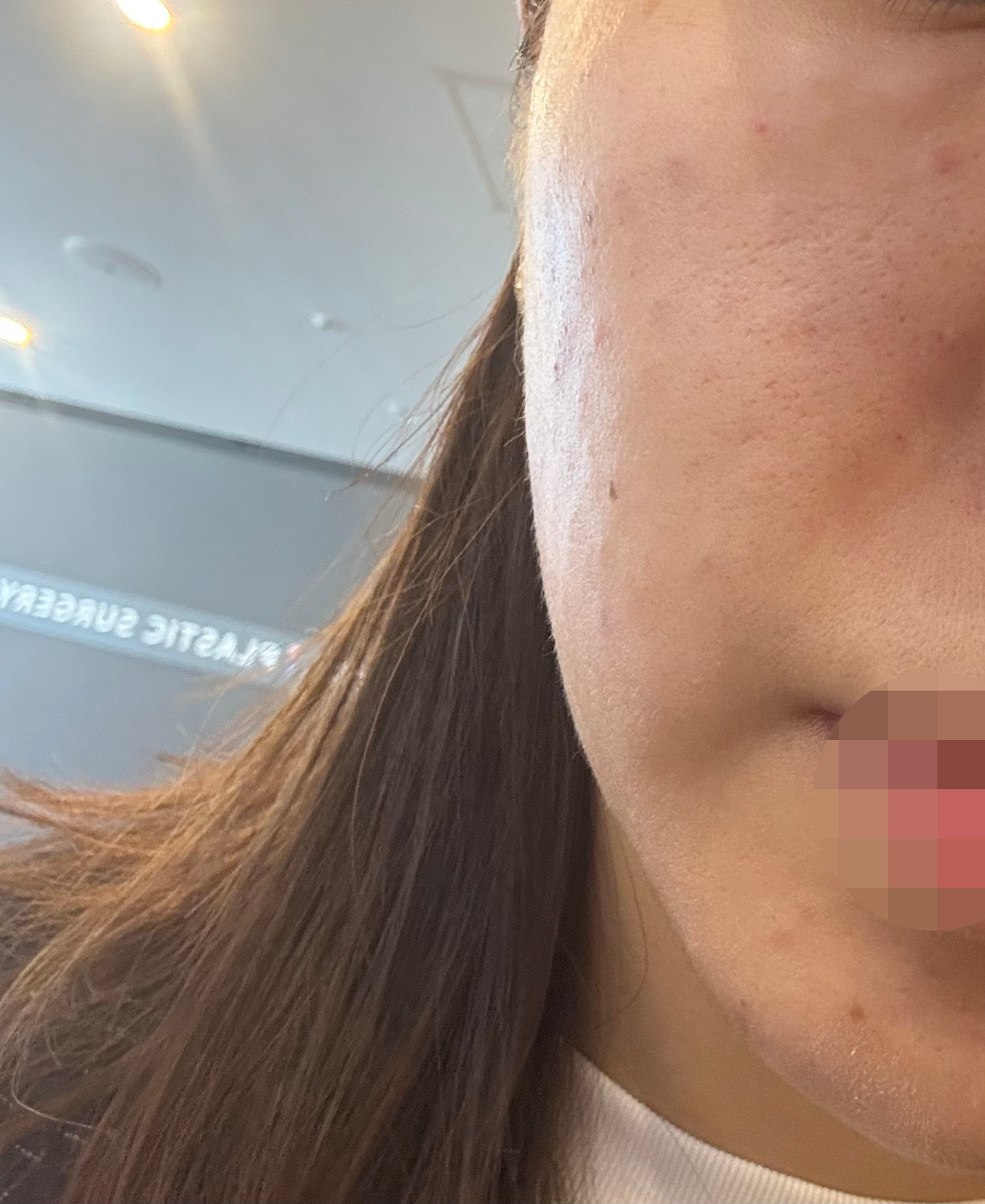 수술후기이미지