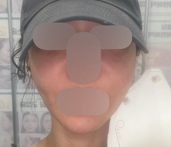 수술후기이미지