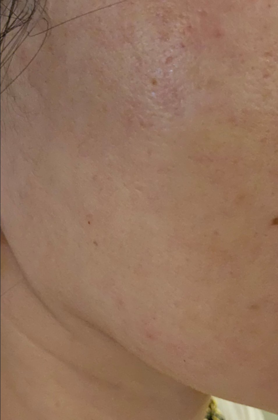 수술후기이미지