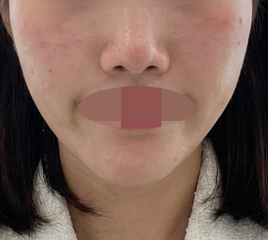 수술후기이미지