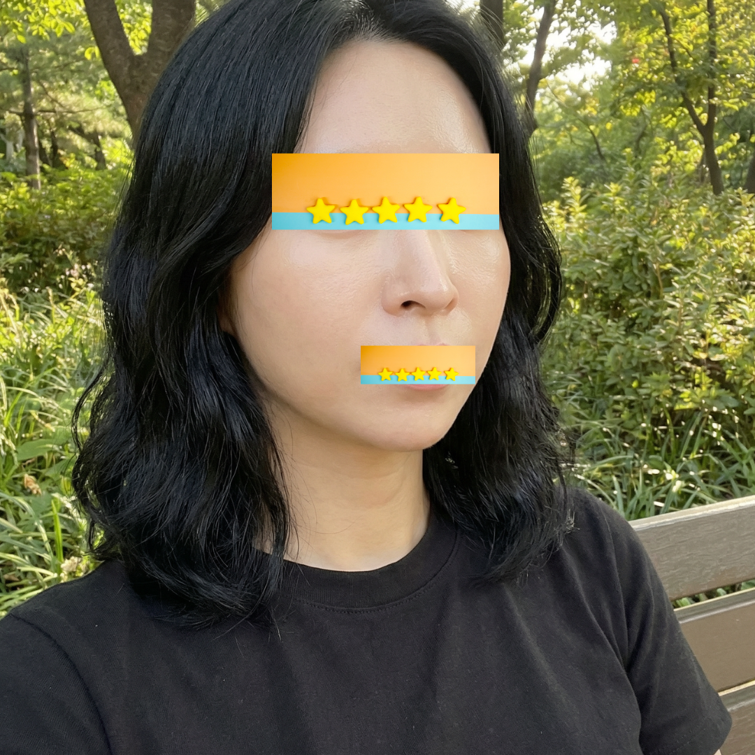 수술후기이미지