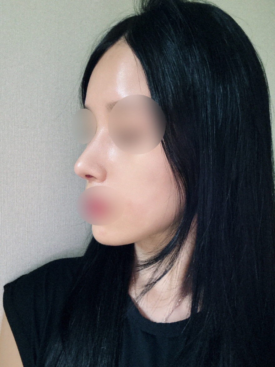 수술후기이미지