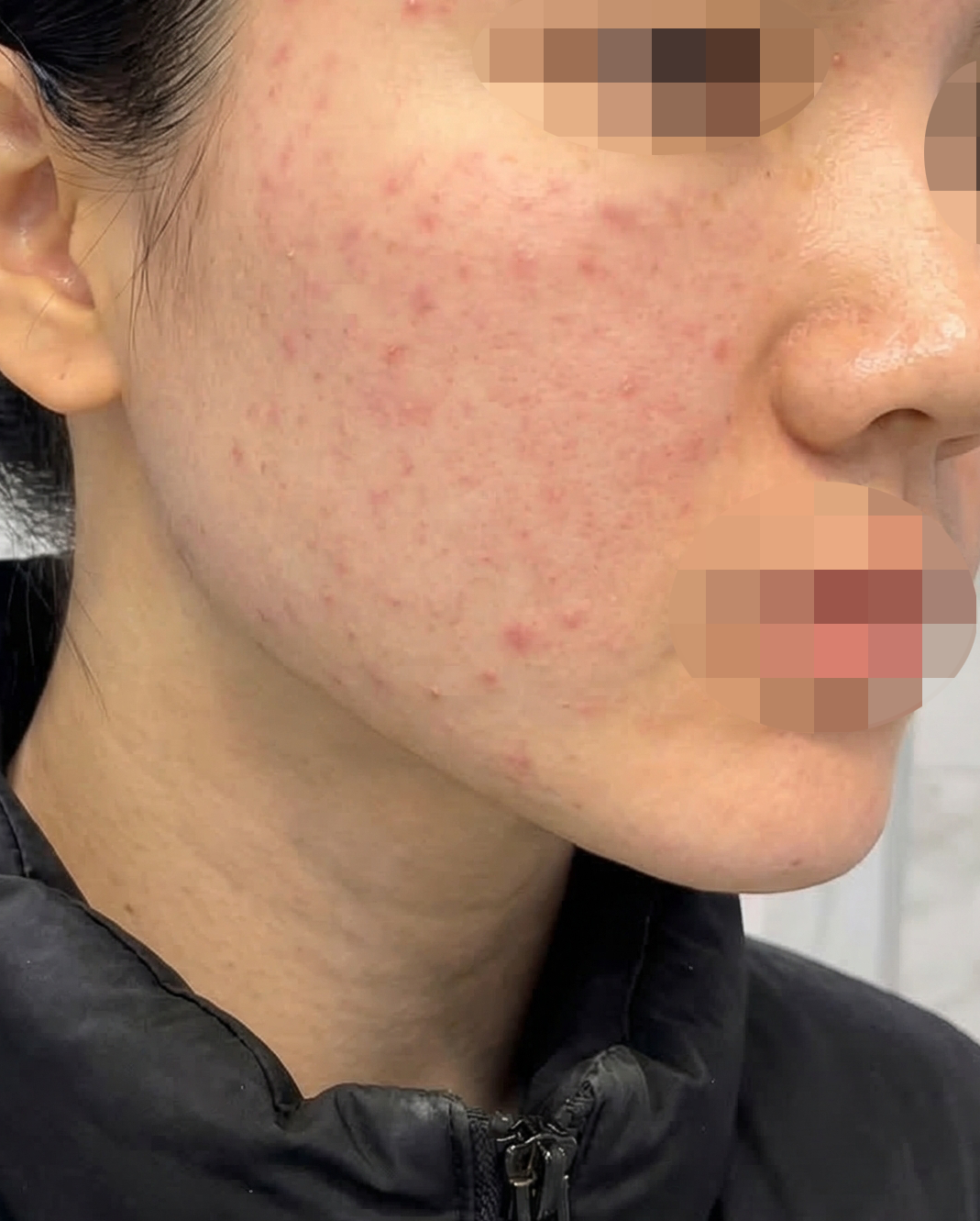 수술후기이미지