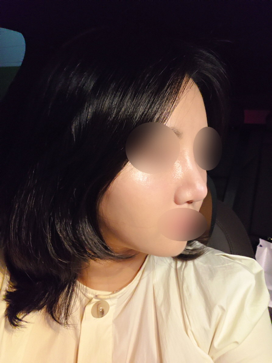 수술후기이미지