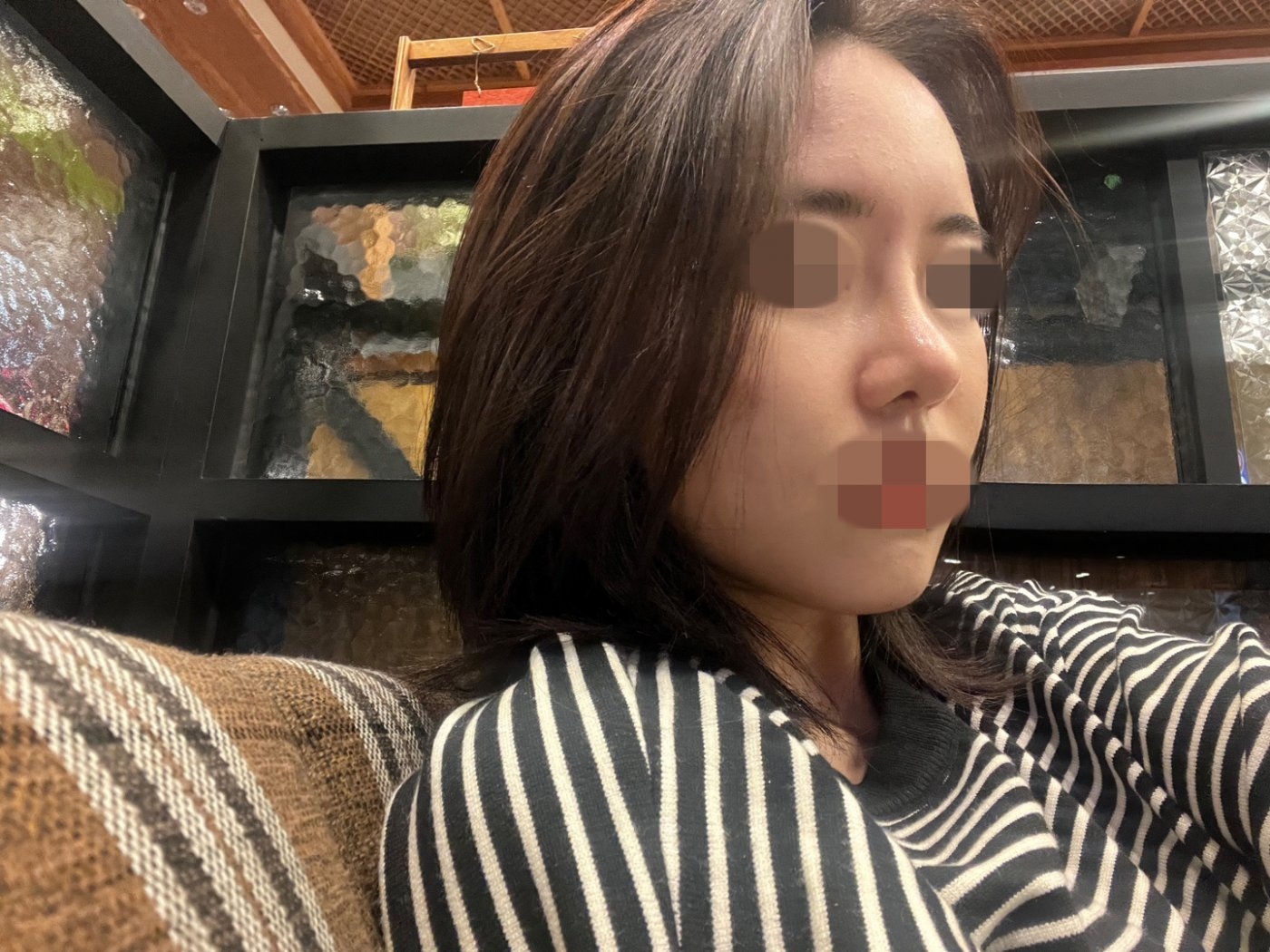 수술후기이미지