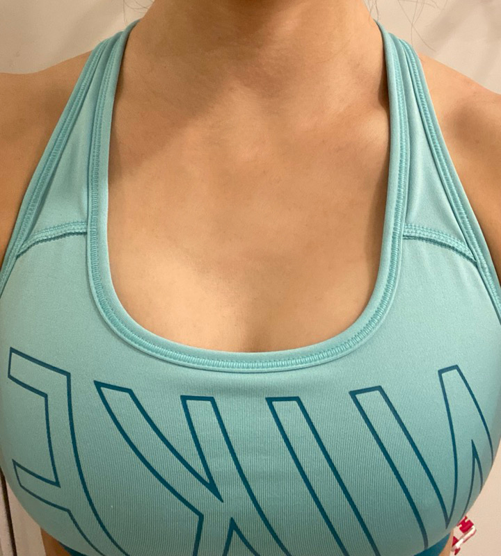 수술후기이미지