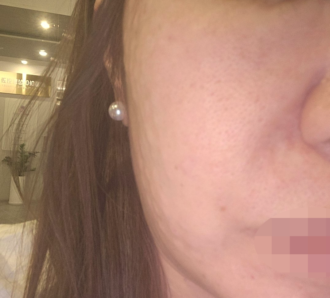 수술후기이미지