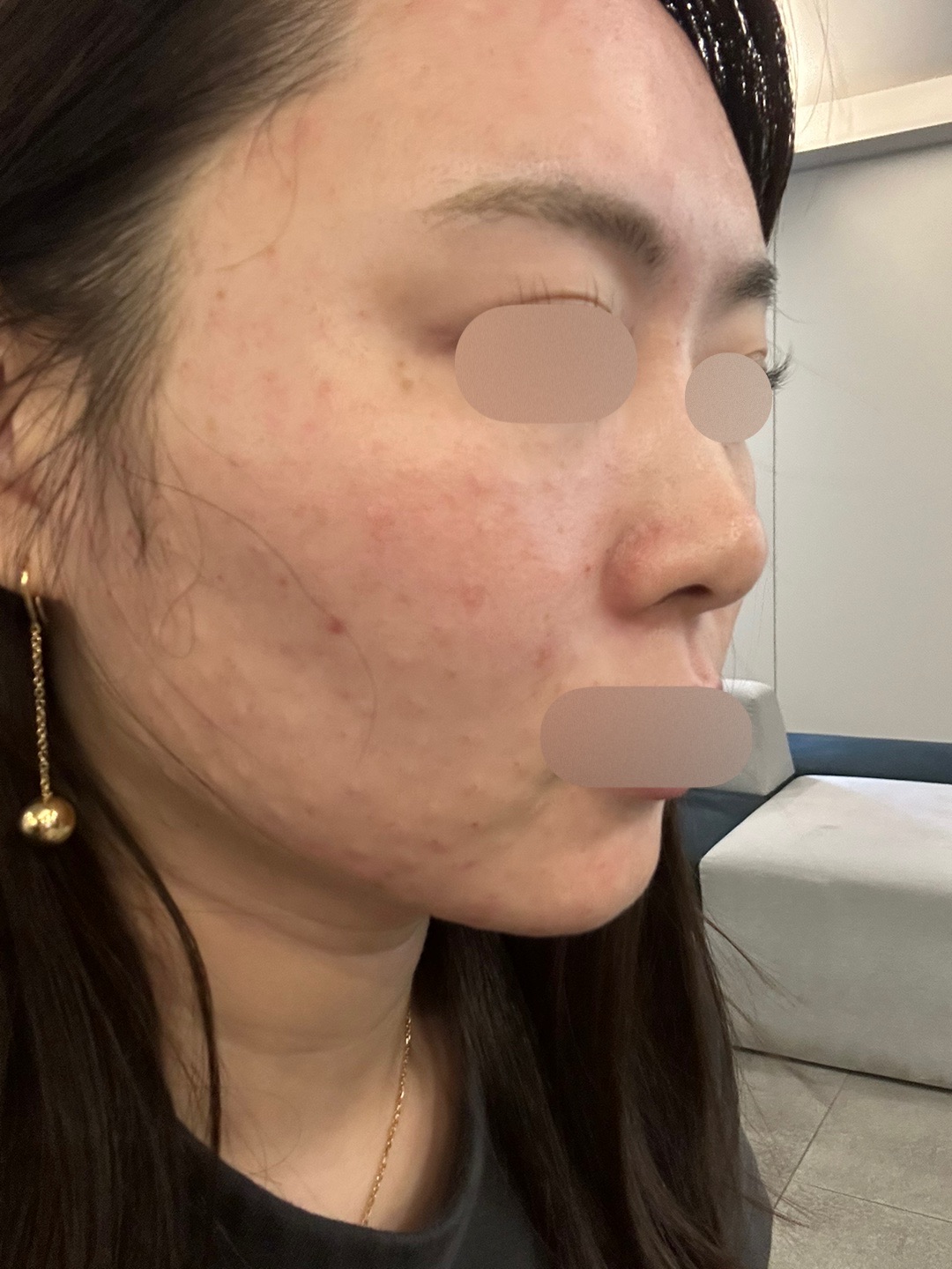 수술후기이미지