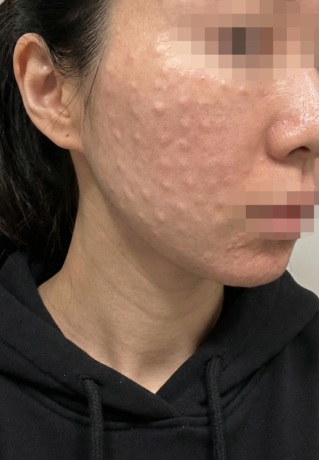 수술후기이미지