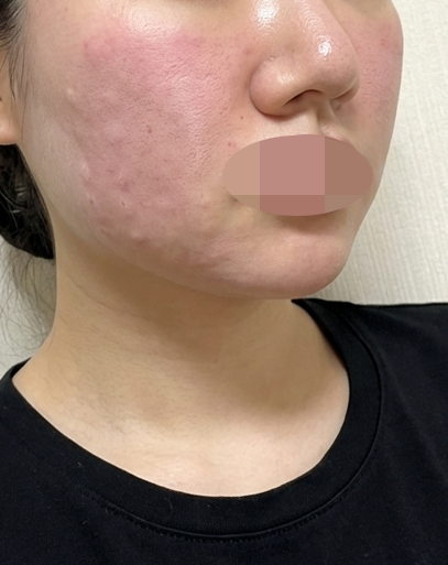 수술후기이미지