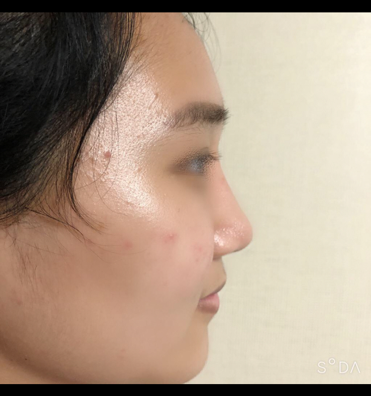 수술후기이미지