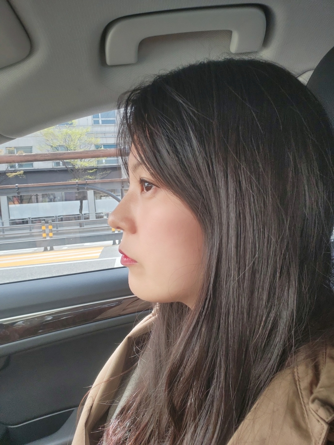 수술후기이미지