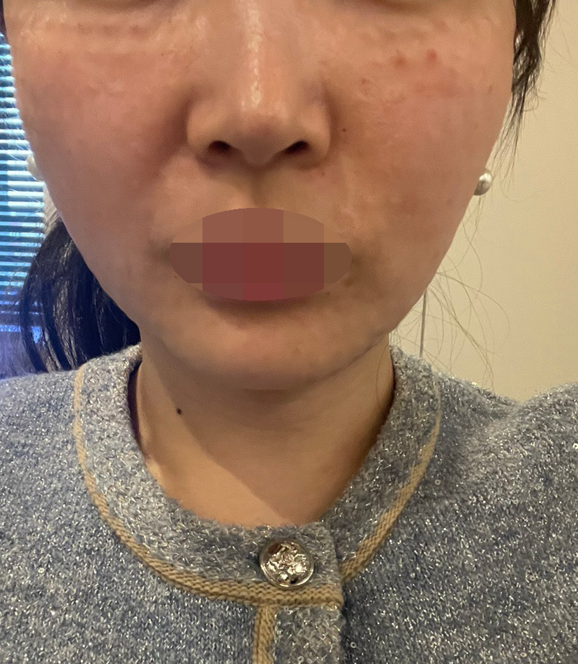 수술후기이미지