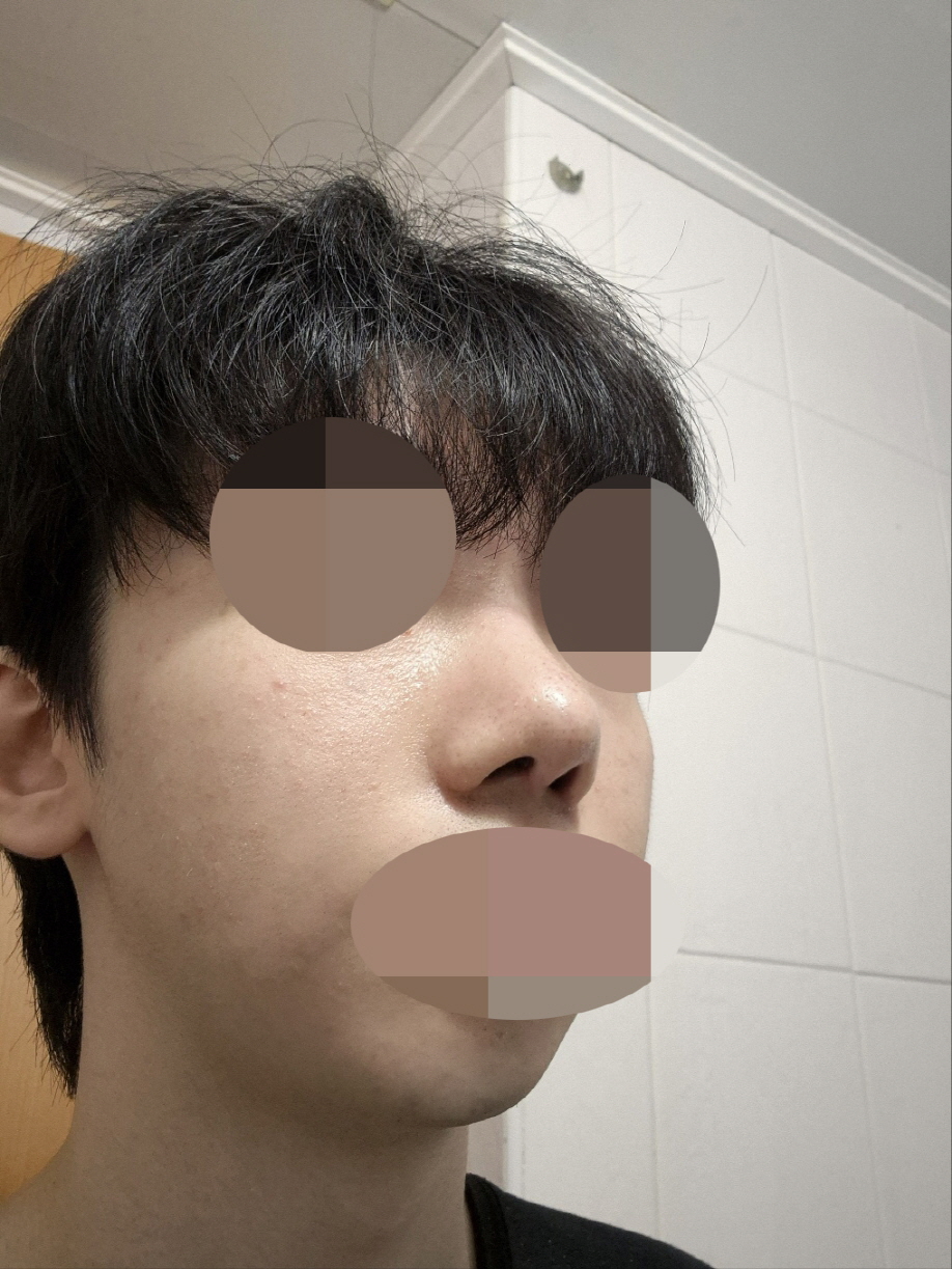 수술후기이미지