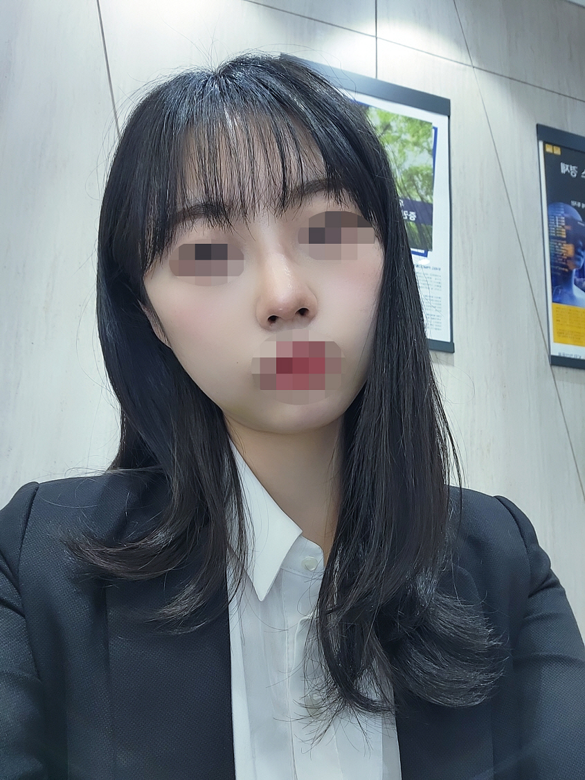 수술후기이미지