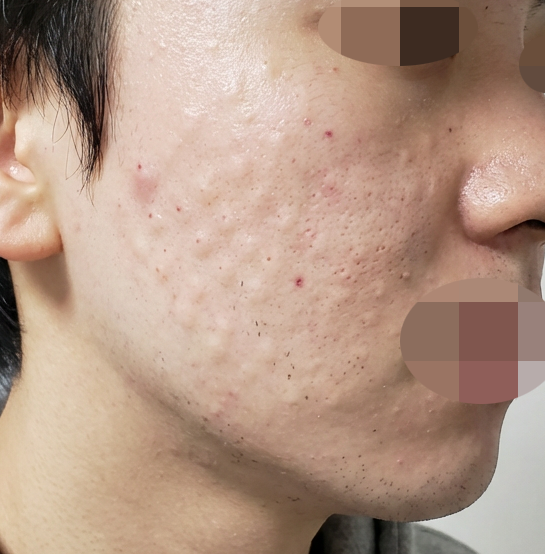 수술후기이미지