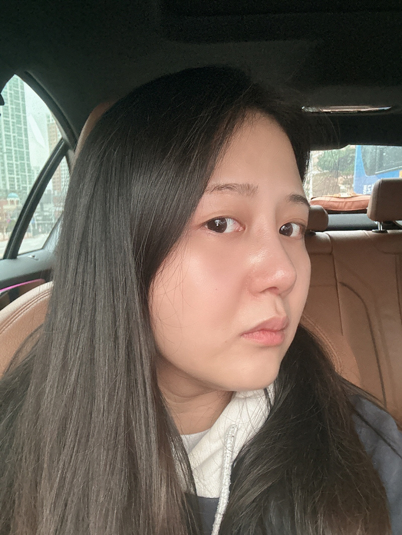 수술후기이미지