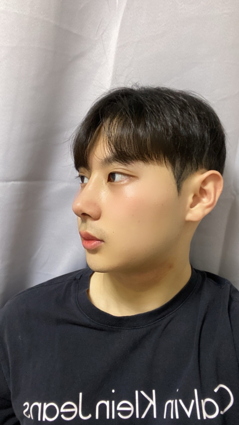 수술후기이미지