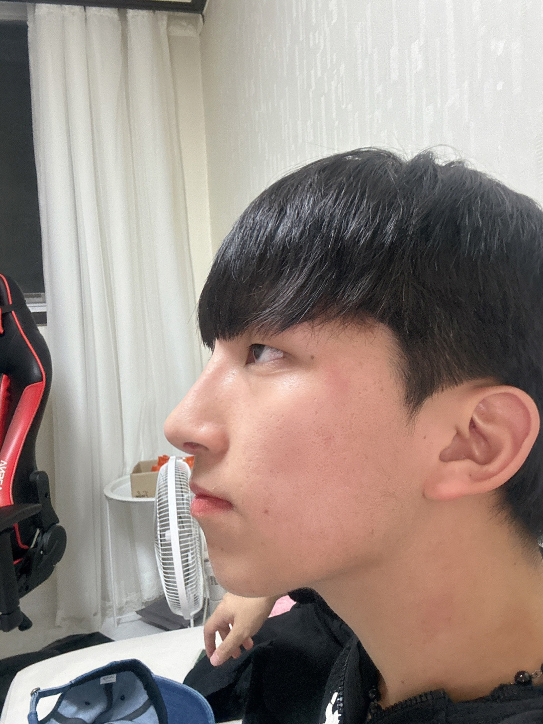 수술후기이미지