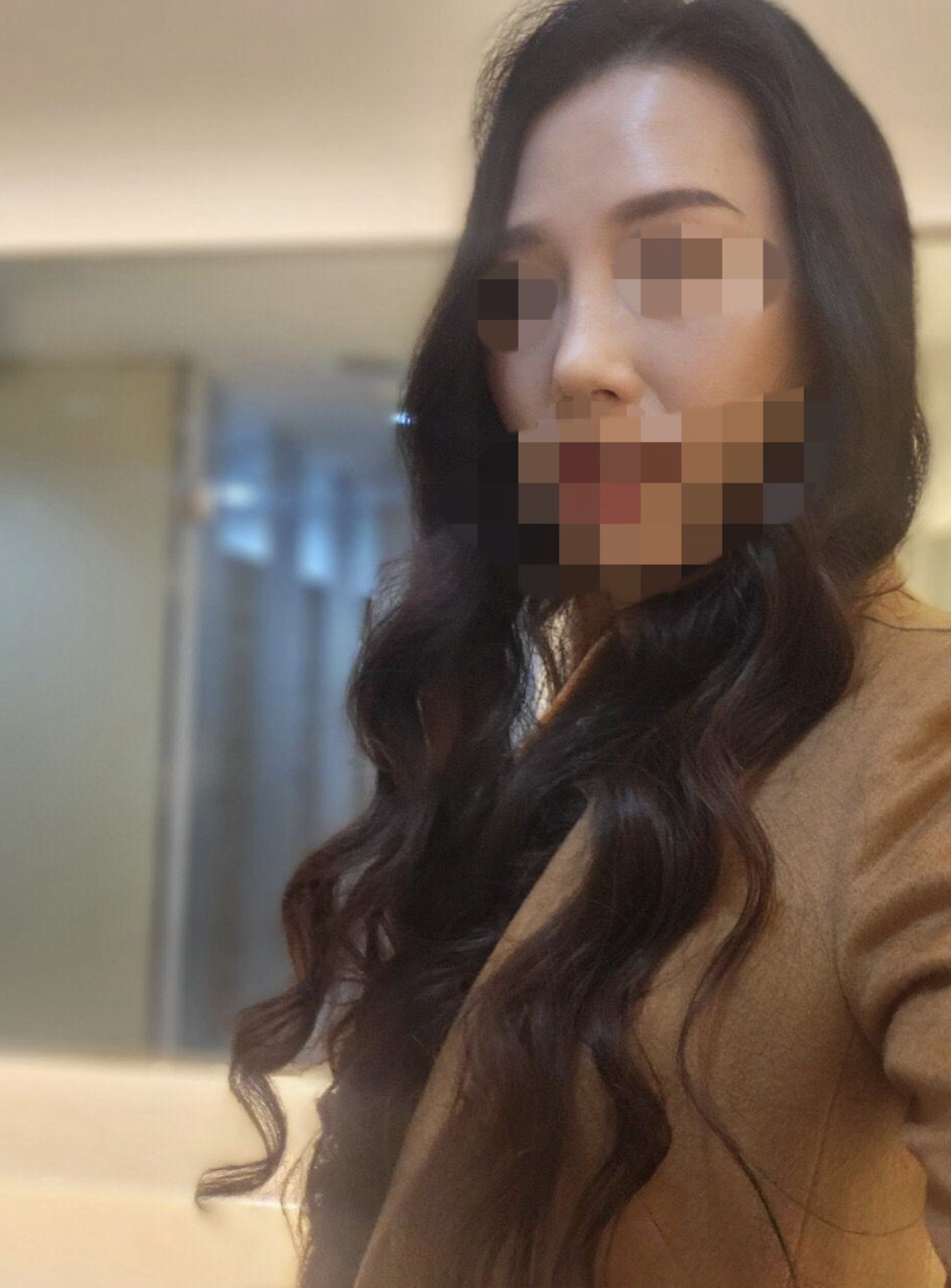 수술후기이미지