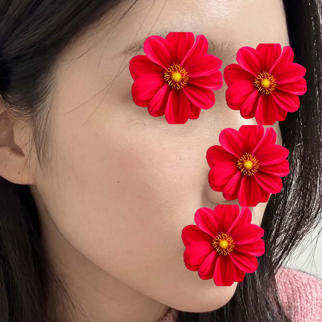 수술후기이미지