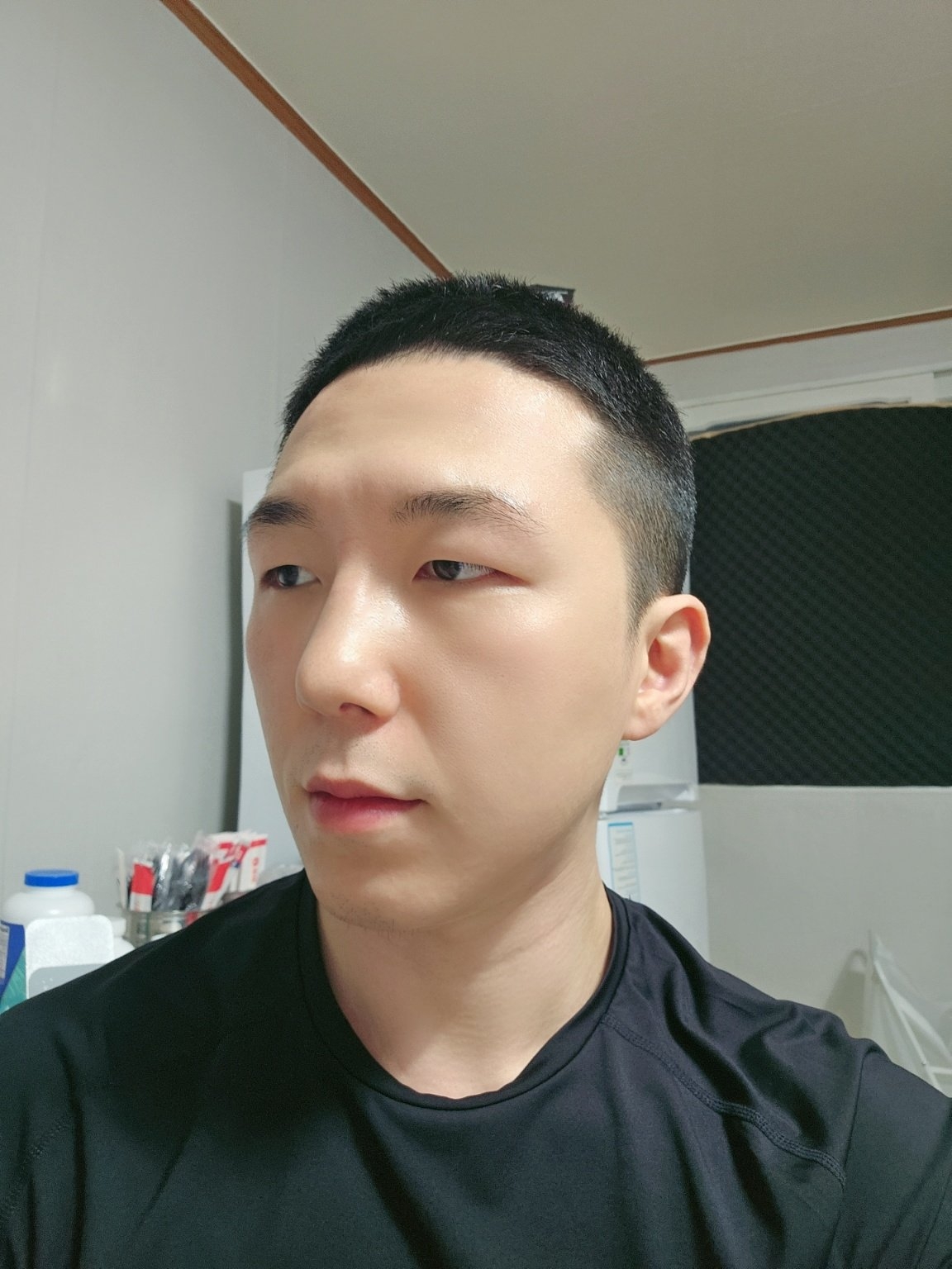 수술후기이미지