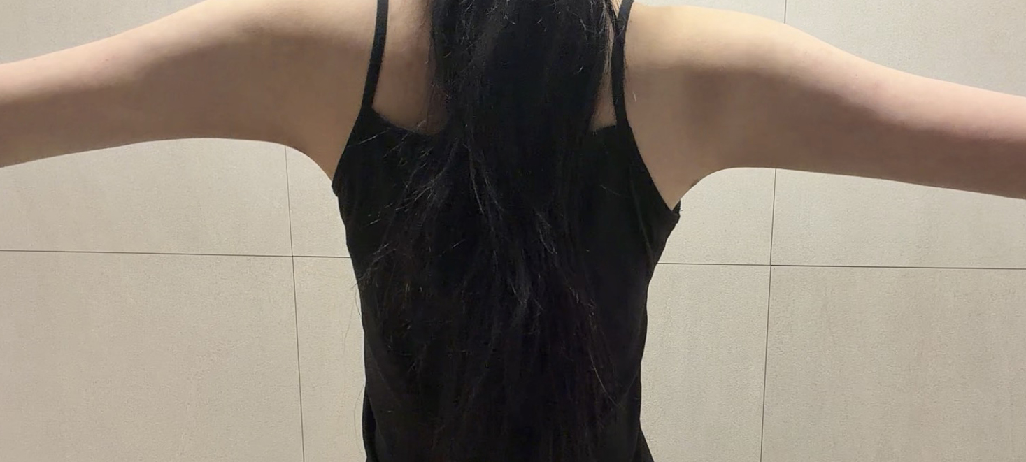 수술후기이미지