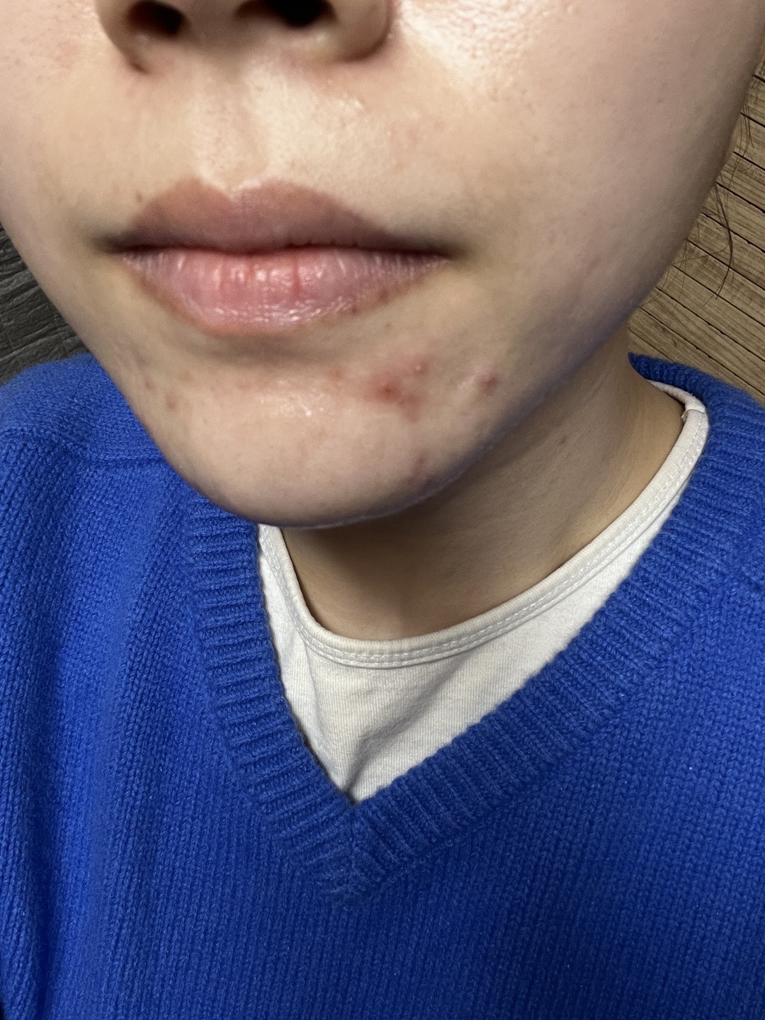 수술후기이미지