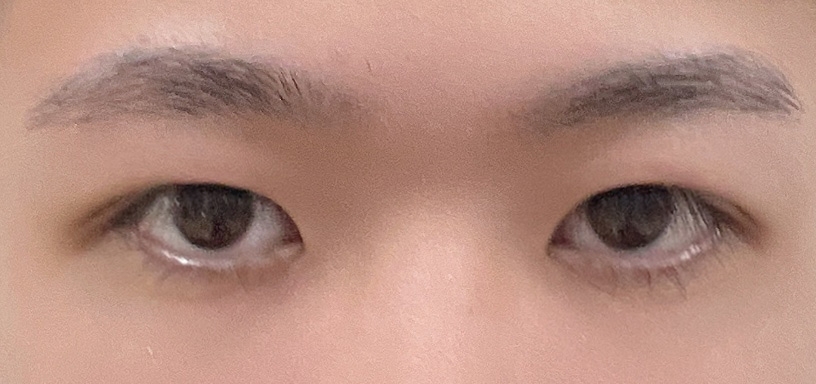 수술후기이미지