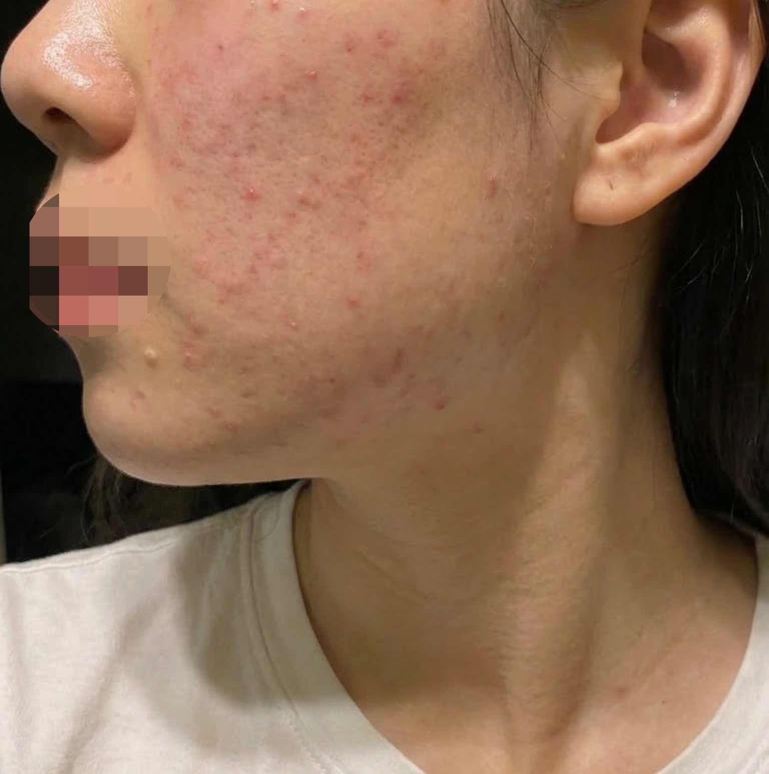 수술후기이미지