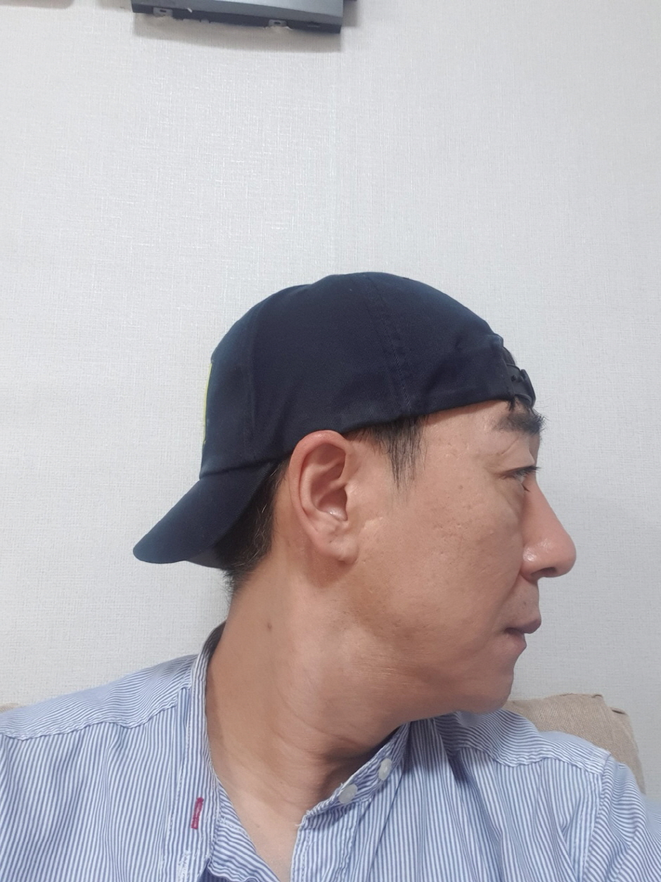 수술후기이미지