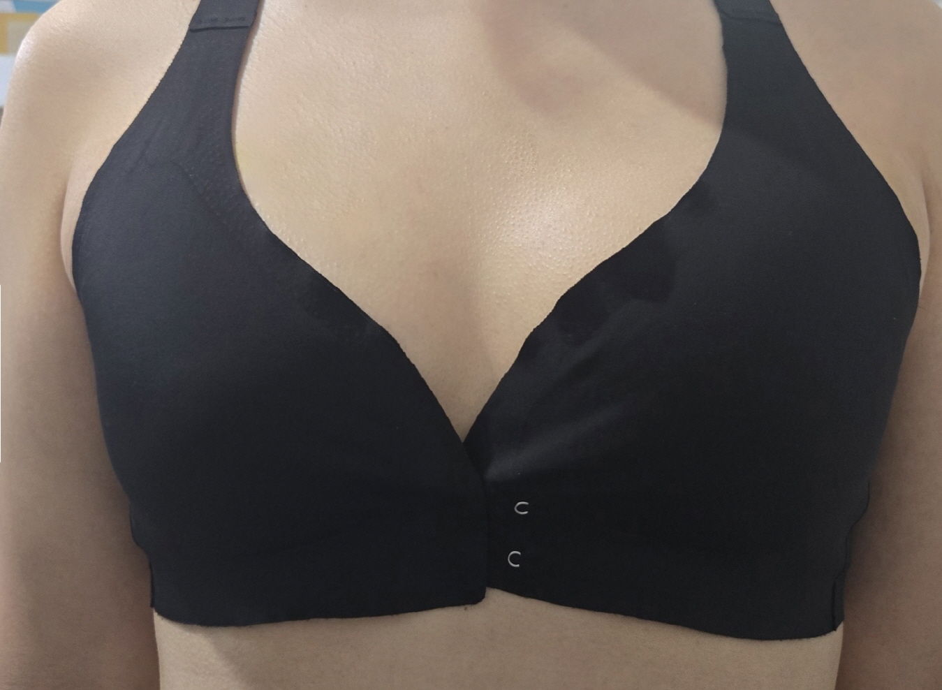 수술후기이미지